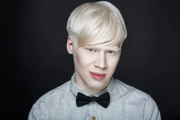 Albino homem branco pele — Fotografia de Stock