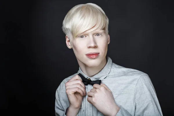 Albino homem branco pele — Fotografia de Stock