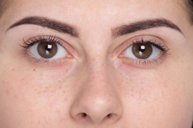 göz yüzünü kapatmak