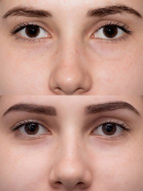 göz yüzünü kapatmak