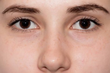 göz yüzünü kapatmak