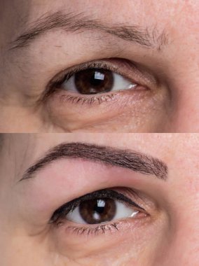 göz yüzünü kapatmak