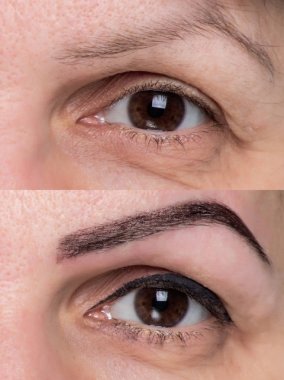 göz yüzünü kapatmak