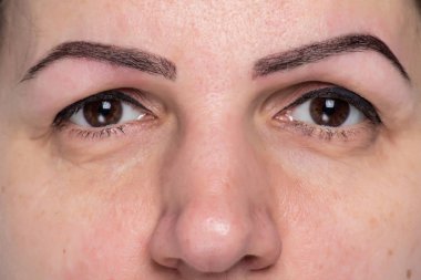 göz yüzünü kapatmak