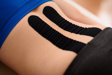 Close up shot of a female patient's lower back with kinesio tape. Kinesiology, physical therapy, rehabilitation concept. Cropped shot close up. clipart