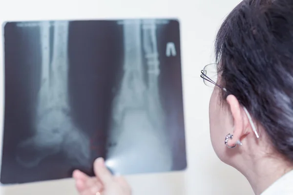Жінка-лікар, яка вивчає рентгенівський знімок — стокове фото