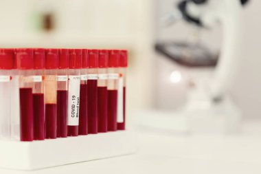 Enfeksiyon kapmış kan örneği tüpte ve mikroskopta araştırma laboratuarındaki masada.