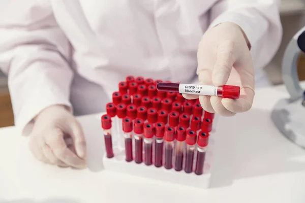 Covid-19 muestra de sangre infectada en tubo de vacío en la mano del médico científico en laboratorio de investigación — Foto de Stock