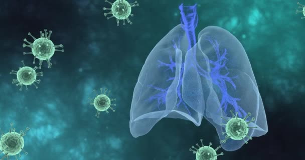 Lidské plíce postižené Covid-19. Sars nemoc, koronaviry v lidských plicích — Stock video