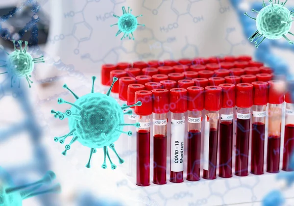 Covid-19 muestra de sangre infectada en tubo de vacío en laboratorio de investigación — Foto de Stock