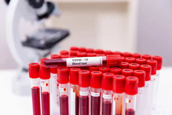 Muestra de sangre infectada con Covid-19 en tubo y microscopio en la mesa del laboratorio de investigación — Foto de Stock