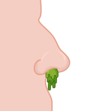 Booger nose. Green slime dripping from his nostril. Large Snot   clipart