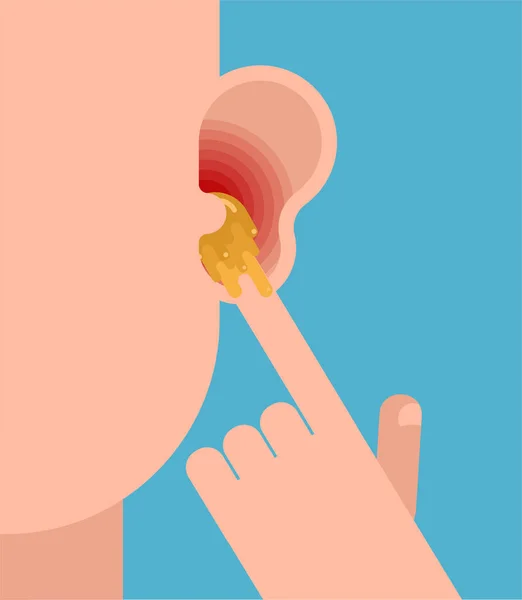 Finger Ear Pick Earwax Your Finger Vector Illustration — Stock Vector