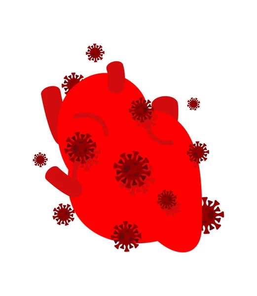 Coronavirus Affected Heart Diseased Internal Organ Aching Viruses Bacteria Human — Stock Vector