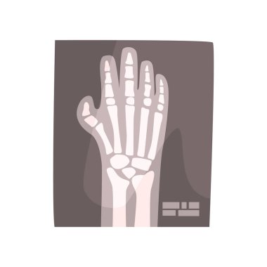 x ışını görüntü el 