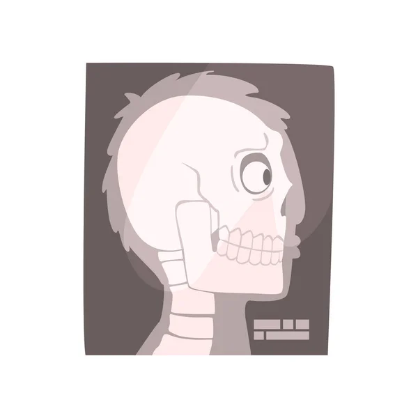 Image radiographique du crâne — Image vectorielle