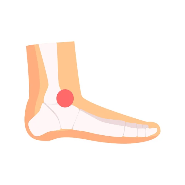 Dolore alle articolazioni della caviglia — Vettoriale Stock