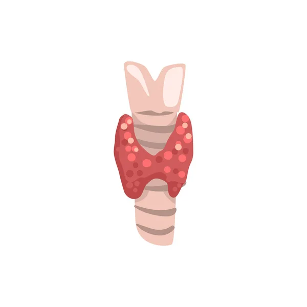 Thyroid gland, human internal organ anatomy vector Illustration on a white background — Stock Vector