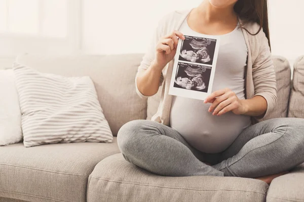 Zwangere vrouw kijken naar haar baby echografie — Stockfoto