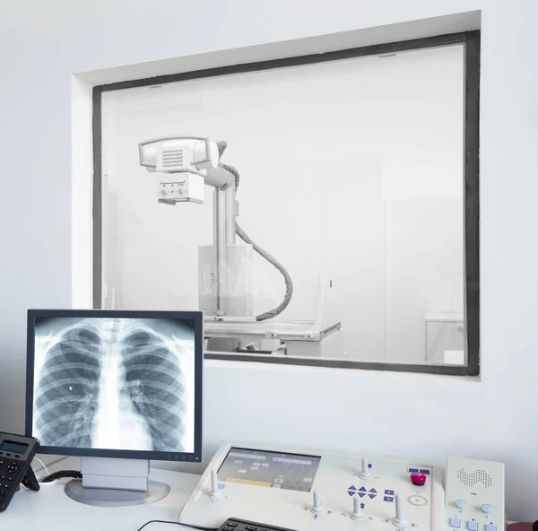 모니터로 흉부 X-ray 를 확대 한 모습 — 스톡 사진
