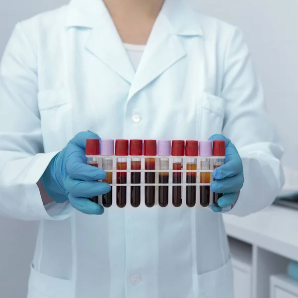 Трубки для анализа крови в женских руках, современная лаборатория — стоковое фото