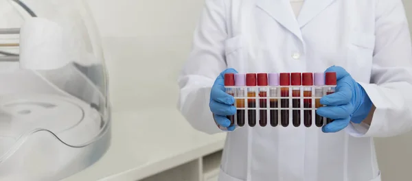 Mulher coletando sangue em tubos de ensaio e trazer para testes — Fotografia de Stock