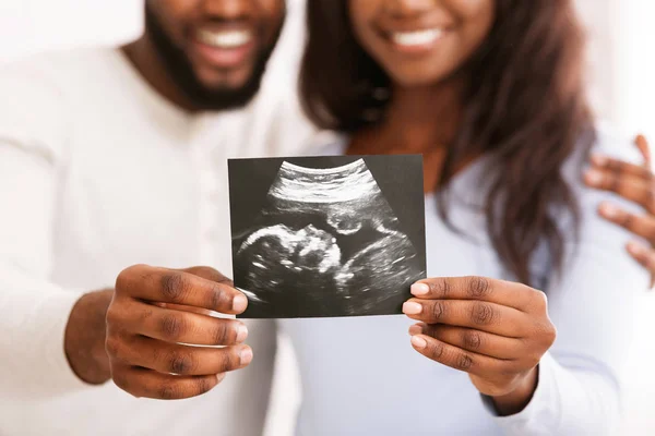 Senyum pasangan hitam memegang gambar USG, mengharapkan bayi — Stok Foto