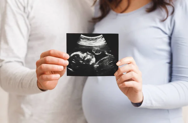 Pregnant woman and her husband showing ultrasound scan of their baby — Stock Photo, Image