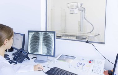 Tanınmayan kadın doktor göğüs röntgenini analiz ediyor.