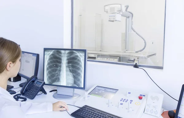 Невпізнавана жінка-лікар, що аналізує рентгенівський знімок грудей — стокове фото