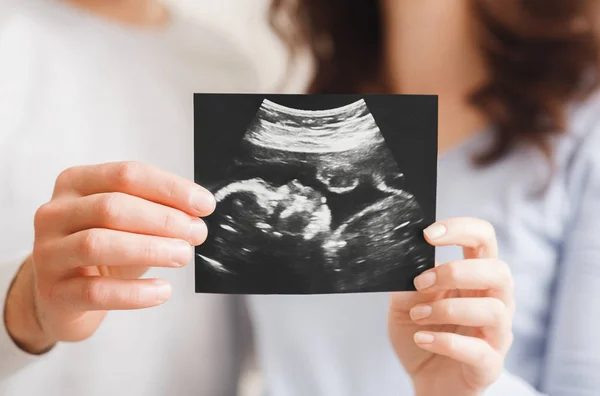 Budoucí rodiče na ultrazvukovém skenu jejich budoucího dítěte — Stock fotografie