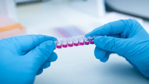 Manos del clínico sosteniendo pequeños tubos de ensayo rosados con sustancia coloreada — Foto de Stock