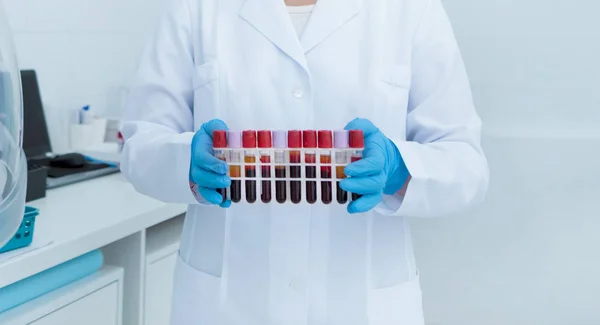 Женщина-врач держит в руках пробирки для анализа крови — стоковое фото