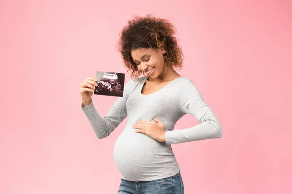 Pertama sonografi. Ibu masa depan yang memegang USG scan — Stok Foto