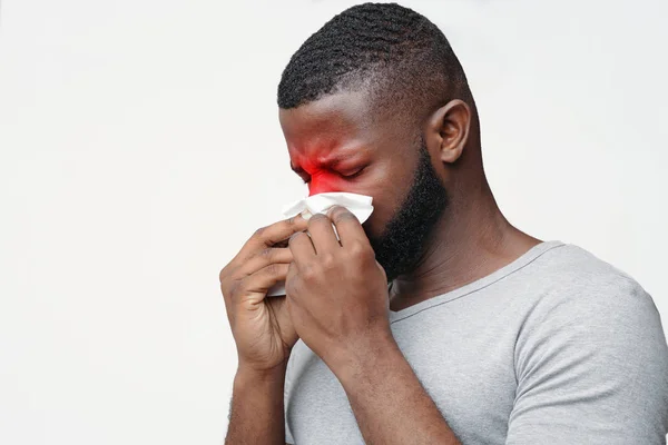 Joven que sufre de sinusitis, tocando la nariz con la servilleta — Foto de Stock
