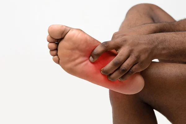 Hombre negro arañando pie desnudo con la fiebre roja — Foto de Stock