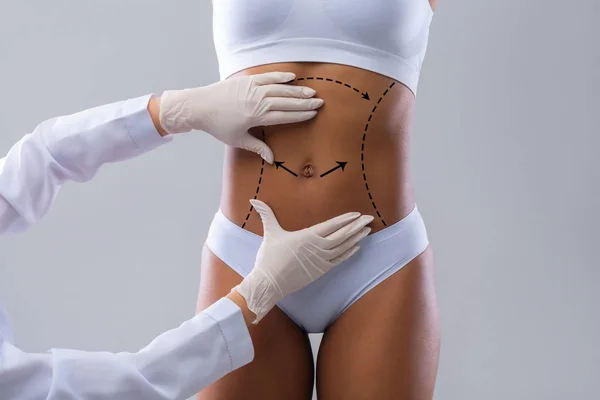 Ärztehände in Handschuhen markieren Linien am jungen weiblichen Körper — Stockfoto