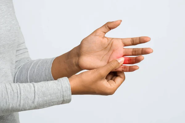 Mladá žena masíruje svůj bolestivý prst, oříznutý — Stock fotografie
