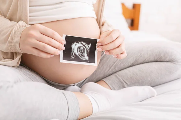 Mujer embarazada sosteniendo imagen de ultrasonido cerca del vientre, primer plano — Foto de Stock