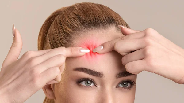Young Woman Squeezing Pimple On Forehead On Beige Background, Closeup — ストック写真