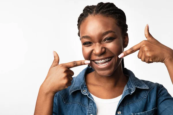 Girl Smiling Pointing Fingers At Brackets On Teeth, Studio Shot — Stockfoto