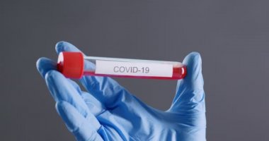 Covid-19 aşısı bilim adamlarının elinde.