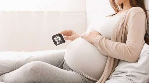 Mujer embarazada sosteniendo imagen de ultrasonido cerca del vientre, primer plano — Foto de Stock