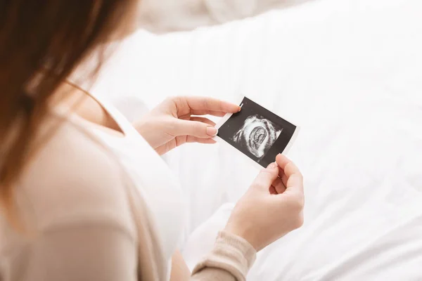 Mujer embarazada acariciando su vientre con sonografía —  Fotos de Stock