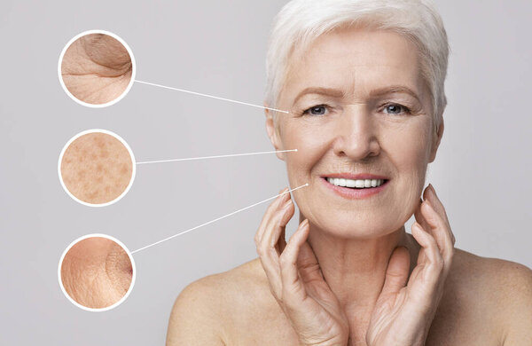 Beautiful senior woman portrait with zoomed zones with skin aging signs