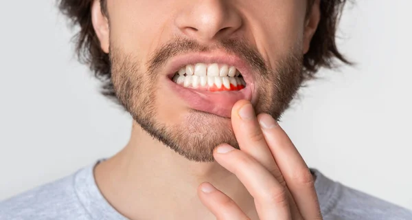 Чоловік, який страждає від зубного болю, розпаду або чутливості — стокове фото