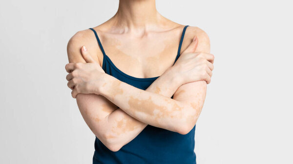 Проблемы человека с разным внешним видом, панорама
