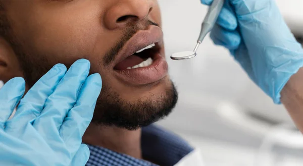 Стоматологічні руки в рукавичках перевіряють рот чорношкірого чоловіка — стокове фото