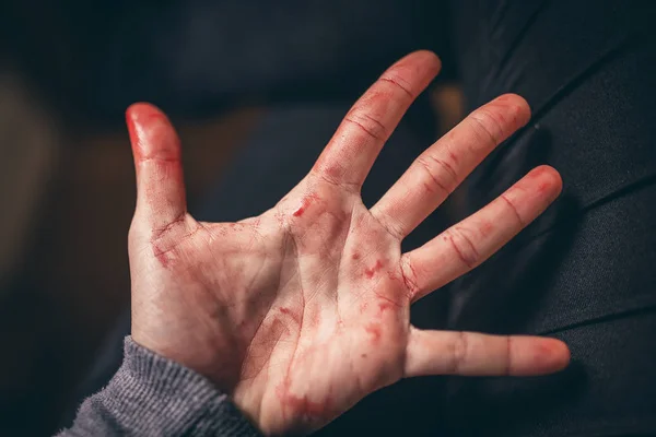 ¿Qué sucede cuando te cortas una vena en el dedo?