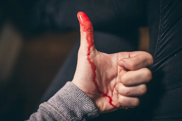 bleeding from cut of finger